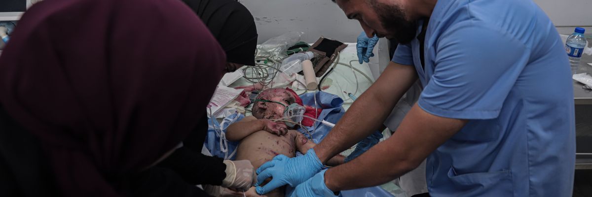Staff at al-Shifa Hospital treat a Palestinian infant wounded in an Israeli airstrike