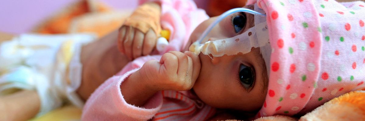 starving yemeni baby