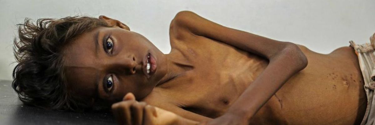 'Entirely Preventable' Deaths of 85,000 Yemeni Children Is Part of What Trump Has Embraced With 'America First' Allegiance to Saudis