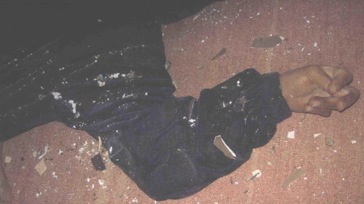 This photo shows the arm of an Iraqi woman killed in the Haditha massacre