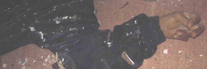 This photo shows the arm of an Iraqi woman killed in the Haditha massacre