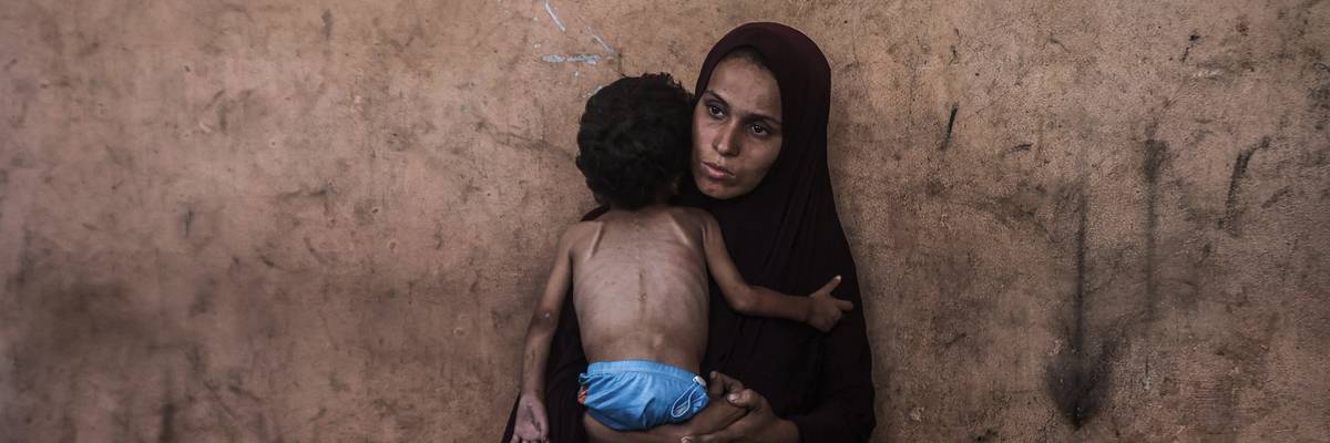 Two-year-old Palestinian Yezen Abu Ful