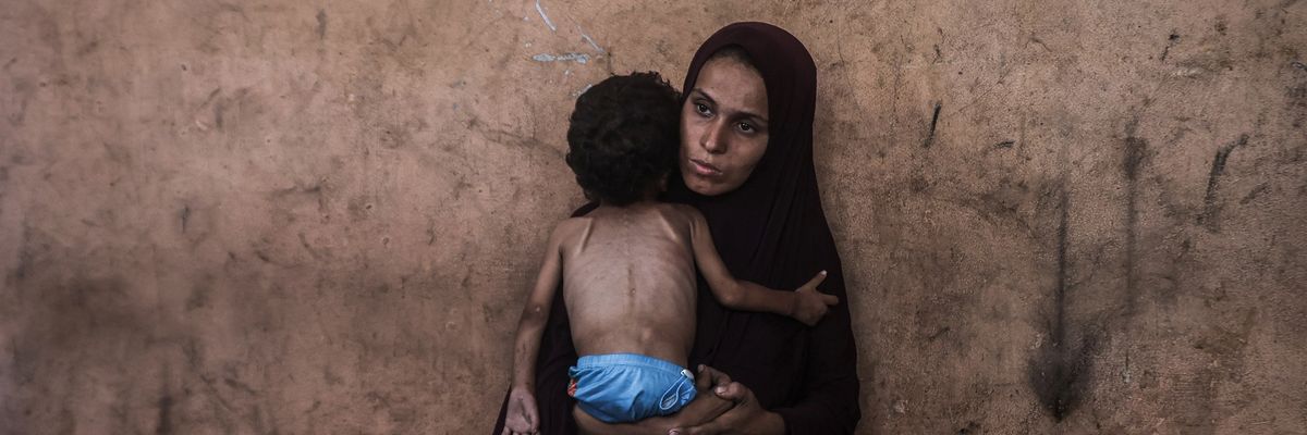 Two-year-old Palestinian Yezen Abu Ful