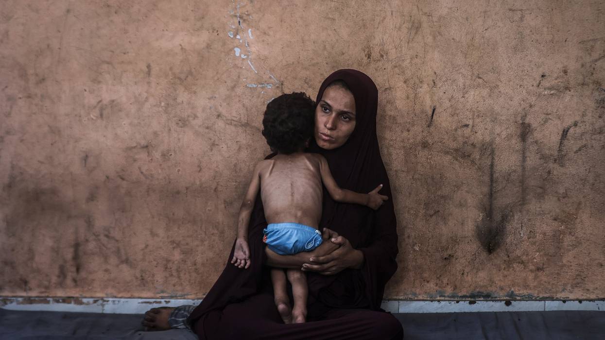 Two-year-old Palestinian Yezen Abu Ful