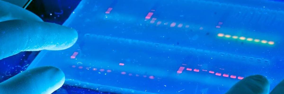 Can Inequality Be Hardwired into Our DNA?