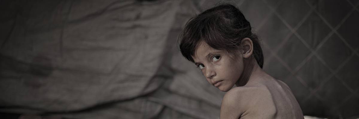 Young girl with malnutrition in Gaza.