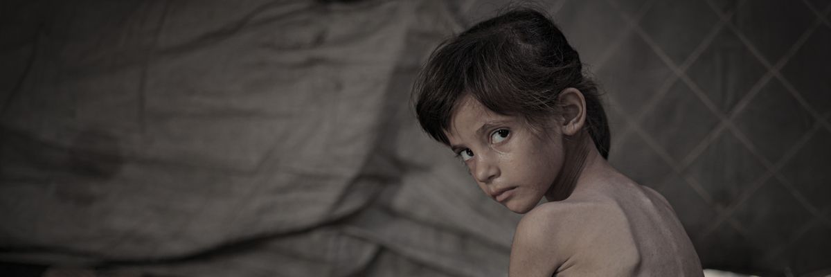 Young girl with malnutrition in Gaza.
