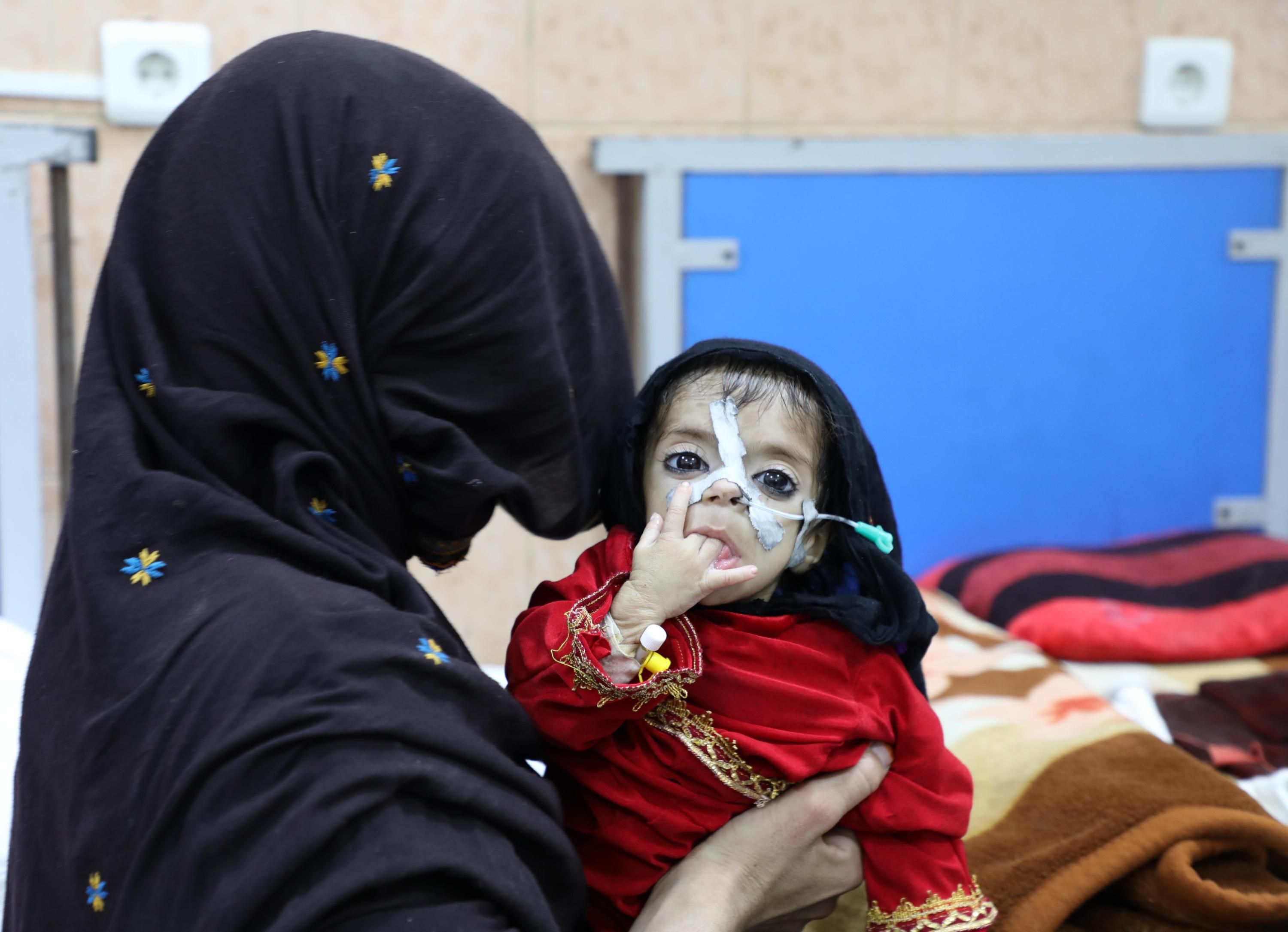 A woman holds an Afghan baby suffering from hunger