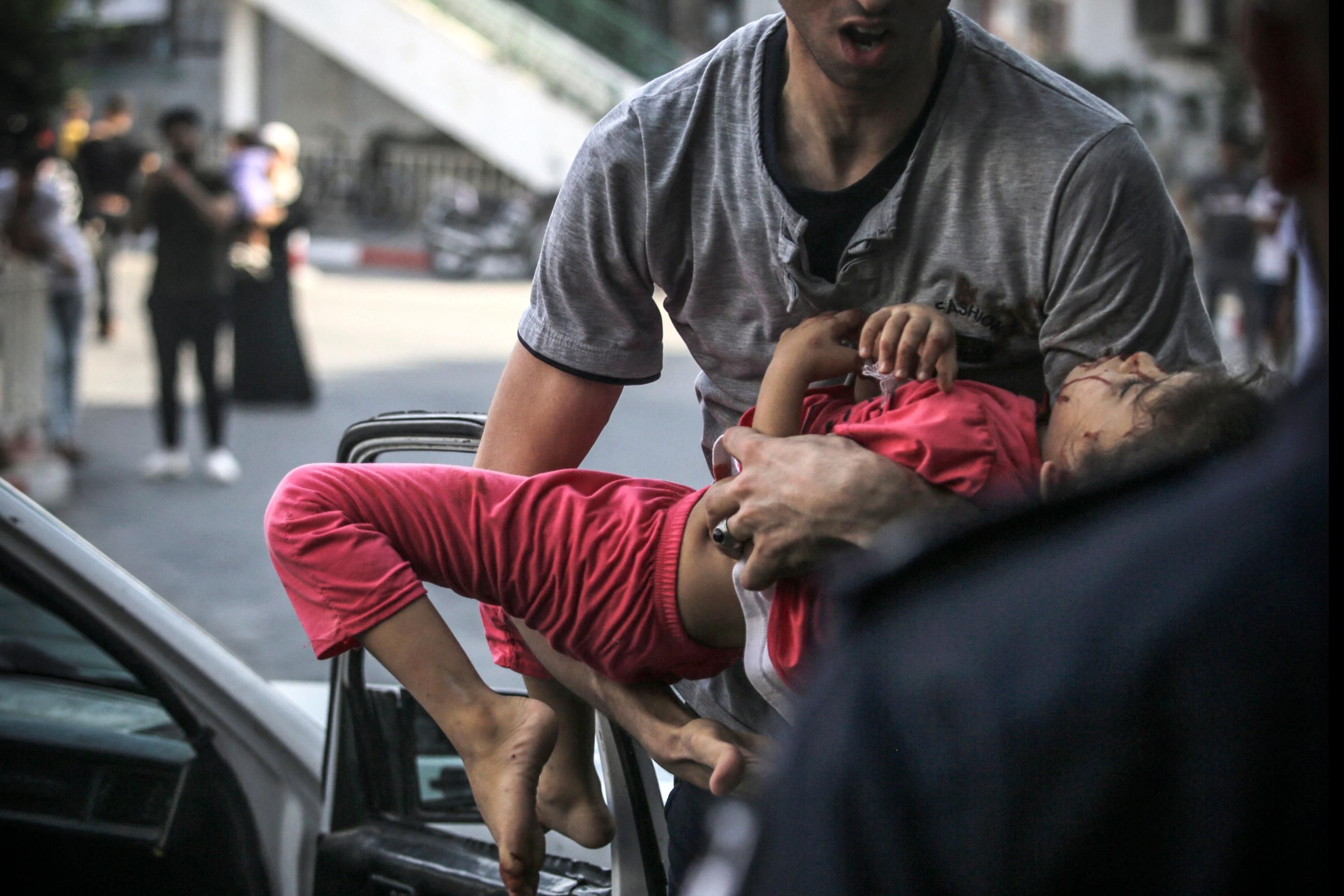 An injured Palestinian girl is transferred to a hospital during an Israeli attack on Gaza