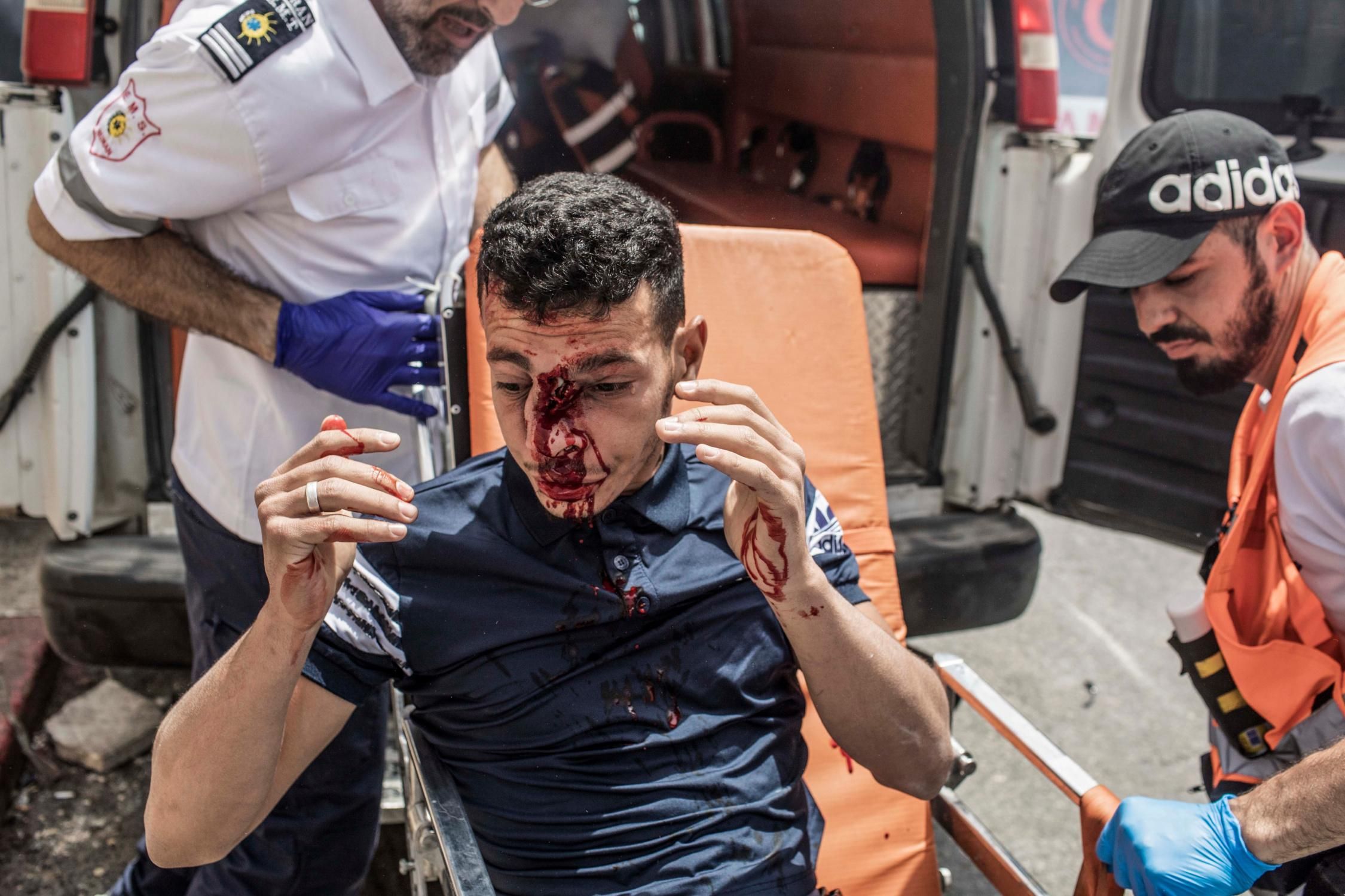 Palestinian paramedics transport a protester wounded by Israeli security forces at Lions Gate in the Al-Aqsa Mosque compound in Jerusalem's Old City on May 10, 2021.