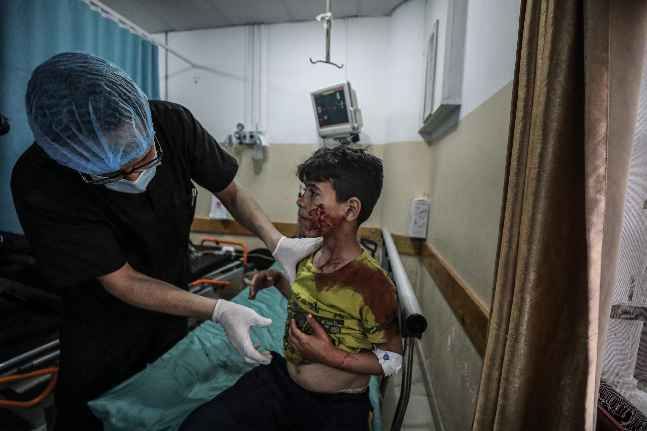 A wounded Palestinian child was brought to Indonesian Hospital to receive medical treatment after Israeli airstrikes in the Gaza Strip on May 10, 2021 in Beit Lahia, Gaza. At least 20 Palestinians, including nine children, were killed, according to local health authorities. (Photo: Ali Jadallah/Anadolu Agency via Getty Images)