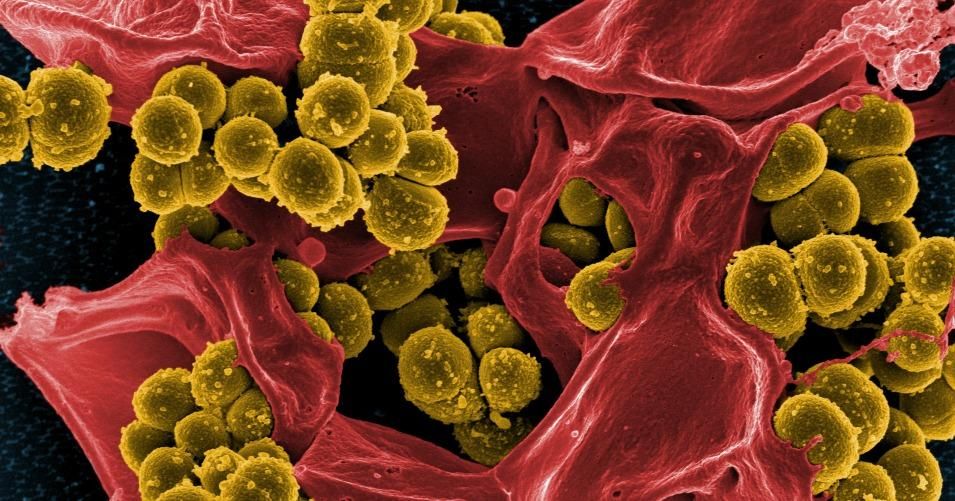 Micrograph of Methicillin-Resistant Staphylococcus aureus (MRSA)