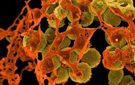 Methicillin-resistant Staphylococcus aureus (MRSA, brown) surrounded by cellular debris. (Credit: NIAID)