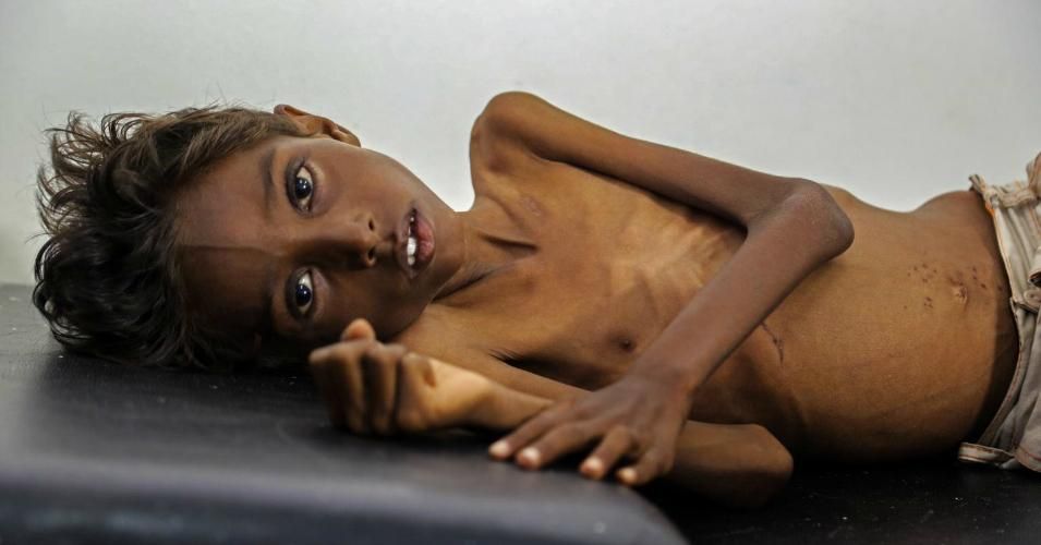 yemeni child