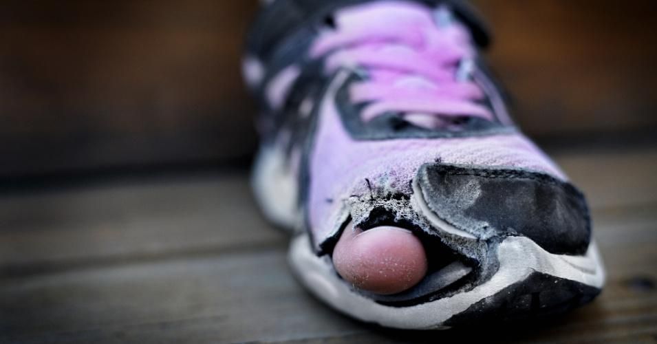 Homeless child wearing old worn out shoes on feet with holes in them toes sticking out. (Photo: iStock/Getty Images)