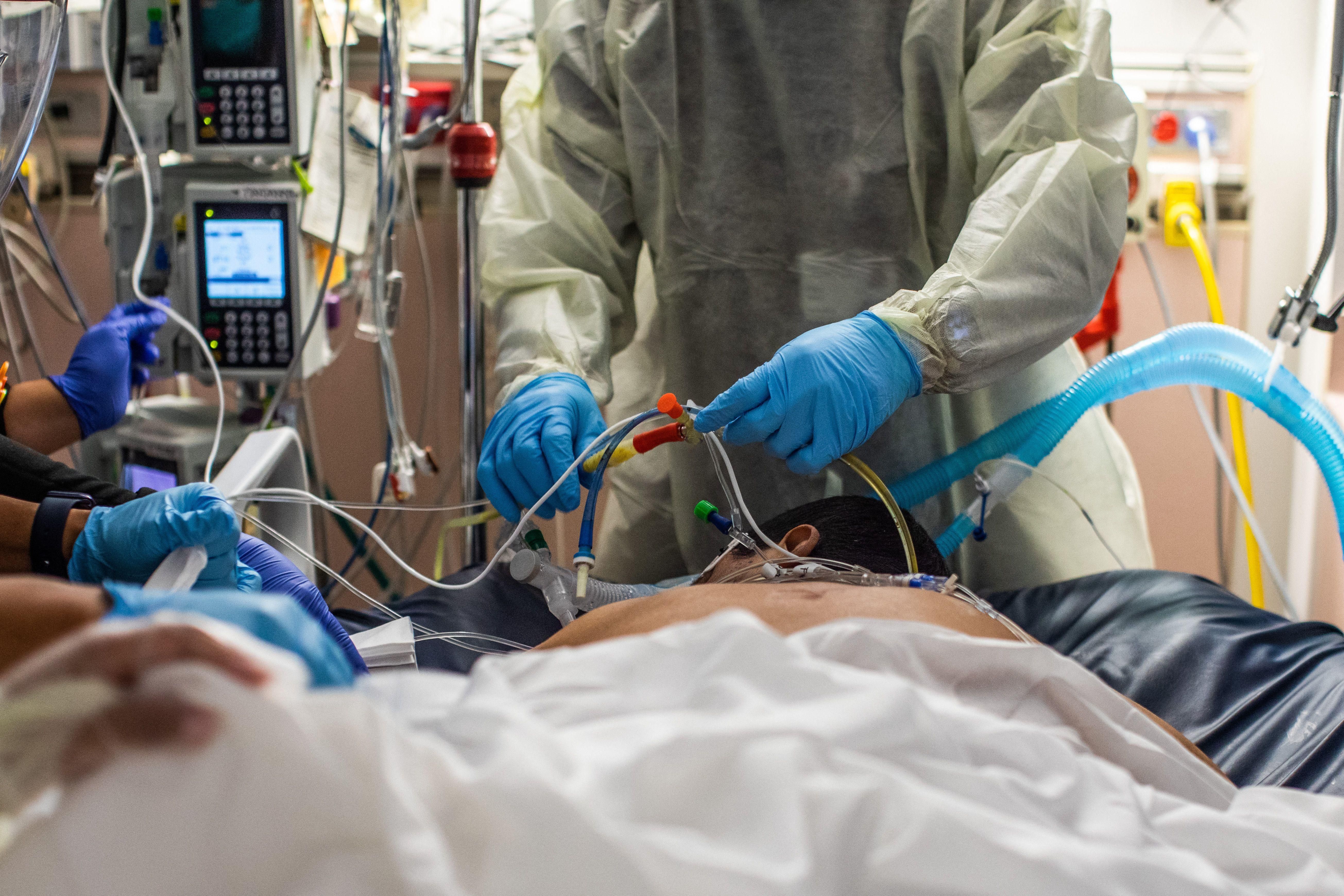Healthcare workers attend to an unvaccinated 45-year-old Covid-19 patient