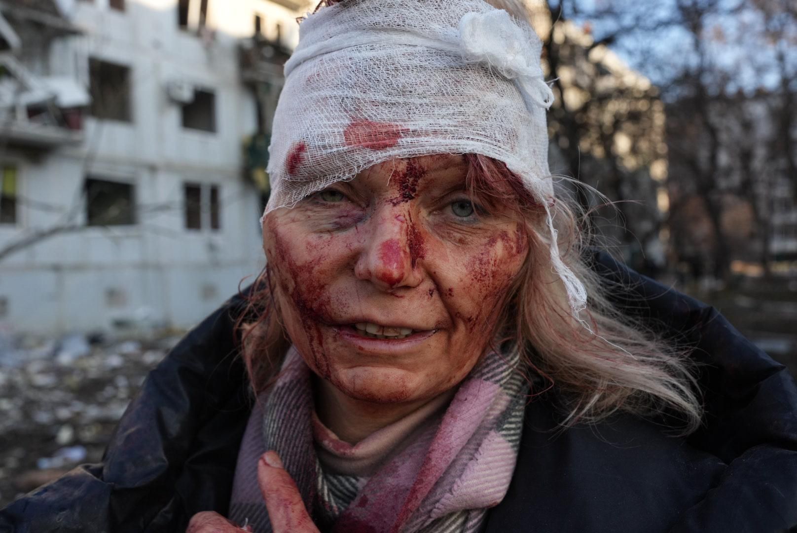 A wounded woman is seen after an apartment complex outside of Kharkiv, Ukraine was hit by Russian bombs on February 24, 2022.